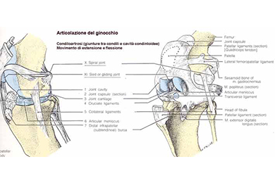 Meniscosi cure e rimedi per il dolore al ginocchio